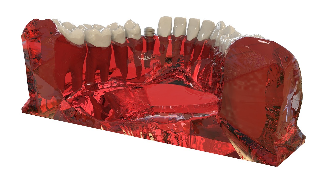 teeth, jaw, 3d model, orthodontics, the implant-2833415.jpg